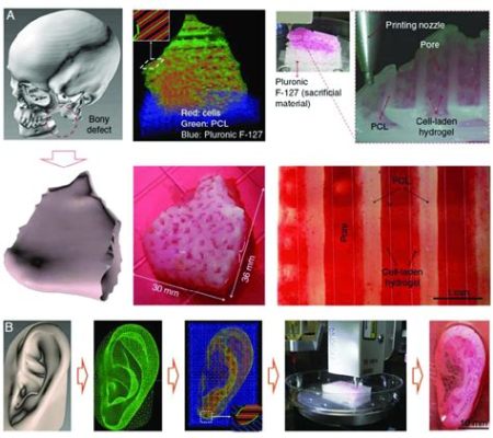  Gelatin: Le matériau polyvalent pour l'impression 3D et la reconstruction osseuse!